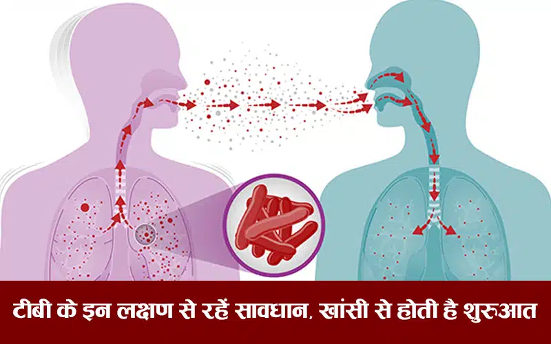 Tuberculosis symptoms